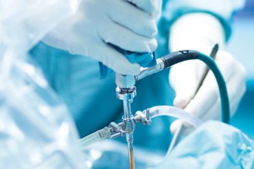 Артроскопия