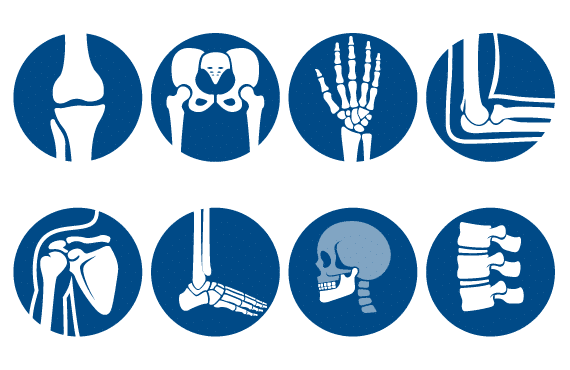 Ostenil, douleurs articulaire, acid-hyaluronique, TRB-Chemedica